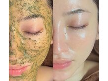 ユズドット(yuzu.)の雰囲気（ハーブ.洗浄.生VC導入！多方面から毛穴にアプローチ＋肌質改善。）