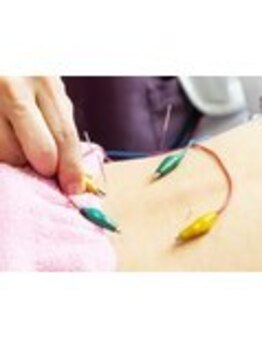 施術所ひびき庵の写真/肩こり・腰痛や美容など気になるお悩みに!★当店の鍼灸施術をご体験ください!