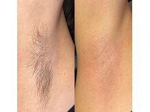 ファースト(1st)/