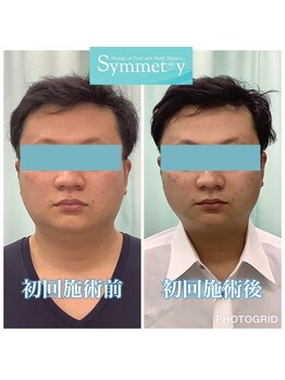 シンメトリー 池袋店/