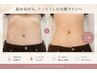 【ぽっこりお腹に】腹部引き締めWINBACK80分 ￥9900