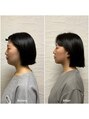 整音(totonone) 顎下と首の筋膜の詰まりをとり、顎下のリンパの流れを確保