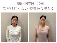 ナツメ鍼灸院(natume鍼灸院)の雰囲気（体だけでなく、頭・お顔も全身ケア。全身調整で整えます）