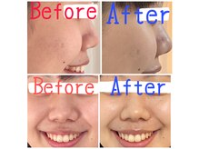 フルコース1回のビフォーアフター♪