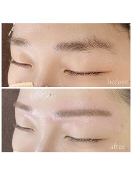 エムアンド(m&)/ワックス脱毛1回