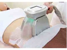 ブランシェ 富山店 × 椿/話題の　【脂肪冷却痩身】！