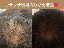 バウ(Bow)の雰囲気（生え際・頭頂部・分け目・M字のお悩みに育毛促進セラピーズ♪）