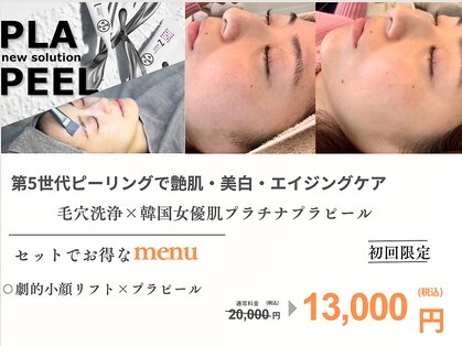 エスポワール(espoir)の写真