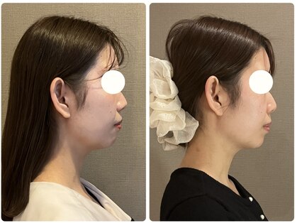 ビクシー(Bixie)の写真