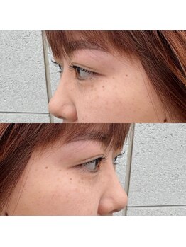 シオン(Cion)/まつ毛パーマ