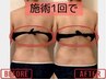 電流セラピスは「微弱電流マッサージな～る」で検索を！
