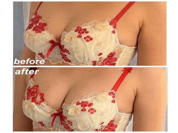 リアン 栄店(Lien)/バストアップのお悩みは当店へ◆