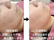 リンパクリニークアリス