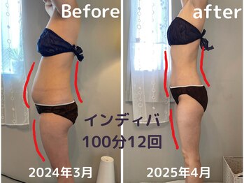 ブリヤン エテルネル 恵比寿(brillant eternel)の写真/【深部加温】で巡りを整え、インディバで理想のサイズダウンへ導く本格ボディケア！
