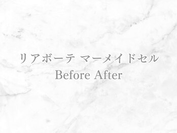 リライン(ReLine)/【リアボーテ マーメイドセル】