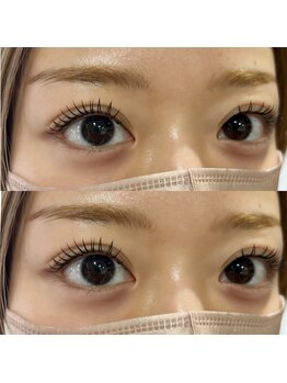 シーディーエム(cdm)/&ヘルシー(マツエク＋パーマ)