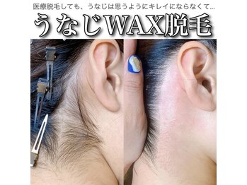 ザ ベッピン(the 別嬪)/うなじWAX脱毛