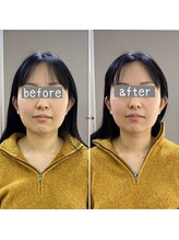 横浜DRT矯正院/小顔・美顔矯正