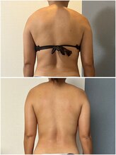 モア(moa)/痩身も!