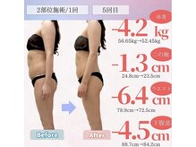 アフリオーラ はなみずき店(affriolant)/ビフォーアフター