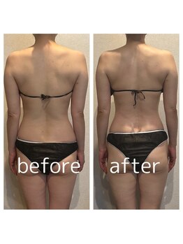 ドゥブレジャンティ(doubler gentil)/ボディメンテナンス