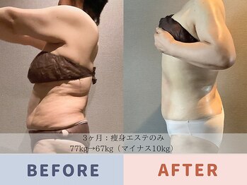 エル 麻布十番(LllL)/【痩身】3ヶ月で-10kg減量