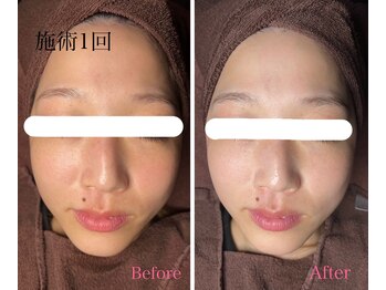 マリーメリー(marie merry)/水玉リフティング