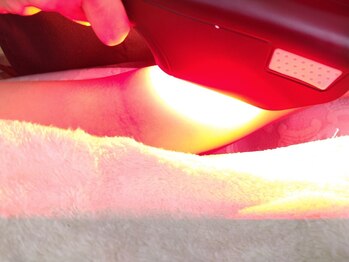 エルモッソ(HERMOSO)の写真/【美肌脱毛ですべすべ素肌へ♪】気になる部位をしっかり施術!お肌に優しく&しっかり脱毛完了♪