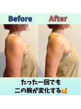 トータルボディケアスマイル(Smile)/二の腕にも効果あります！