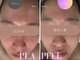 クリア 麻布十番(CLEAR)の写真