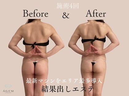 アージェム(AGEM)の写真