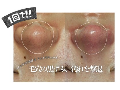 アマランサス(Amaranthus)の写真