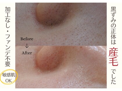 レヴィート(Revept)の写真