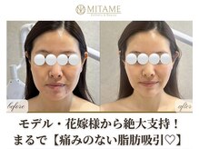 ミタメ 銀座店(MITAME)の雰囲気（SNSで話題!リピ率90％◎最先端バレない”脂肪分解”で速攻小顔♪）
