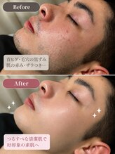 アルゴ 前橋店(ALGO)&nbsp;ビフォー アフター