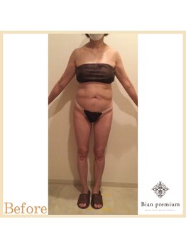 ビアン プレミアム 烏丸御池店(Bian premium)/Before