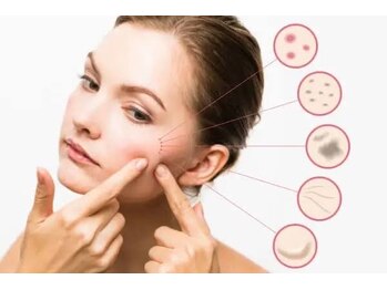 バニスティ 酒田店/光フェイシャルでお肌の悩み改善