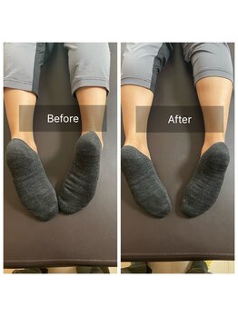 たんぽぽ整骨院鍼灸院/脚長差による体の不調。