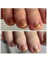 ドクターネイル爪革命 十条店/爪ケア