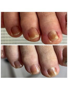 ドクターネイル爪革命 十条店/爪ケア