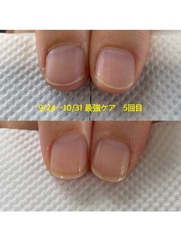 コンプレックスを解消！