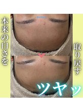 ハニエル(Haniel)/カーボキシービフォーアフター