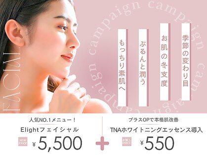 ジェモ(Jemo)の写真