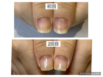 アンドネイル 海老名(&nail)/3週間で。。。