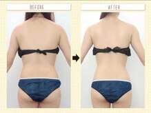 エステアンドトレーニング ビビ(ViVi)/背中