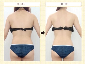 エステアンドトレーニング ビビ(ViVi)/背中