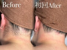 ポノ(pono)の雰囲気（【男性うなじ脱毛】うなじが整うだけで印象UP！◎）