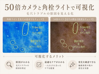 ステラ(Stella)の写真