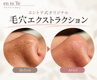 エントテ(en to Te)
