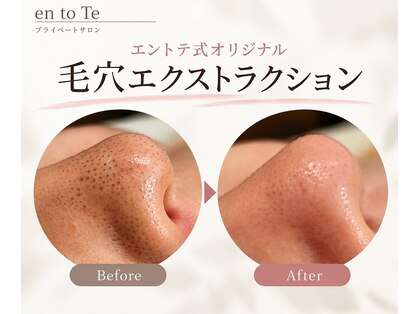エントテ(en to Te)の写真